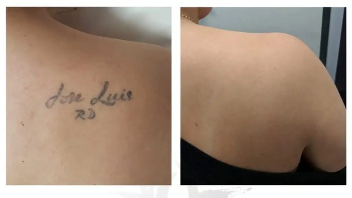 Tattoo aftercare Guidelines | Aliens Tattoo What Should You Avoid After Getting a Tattoo