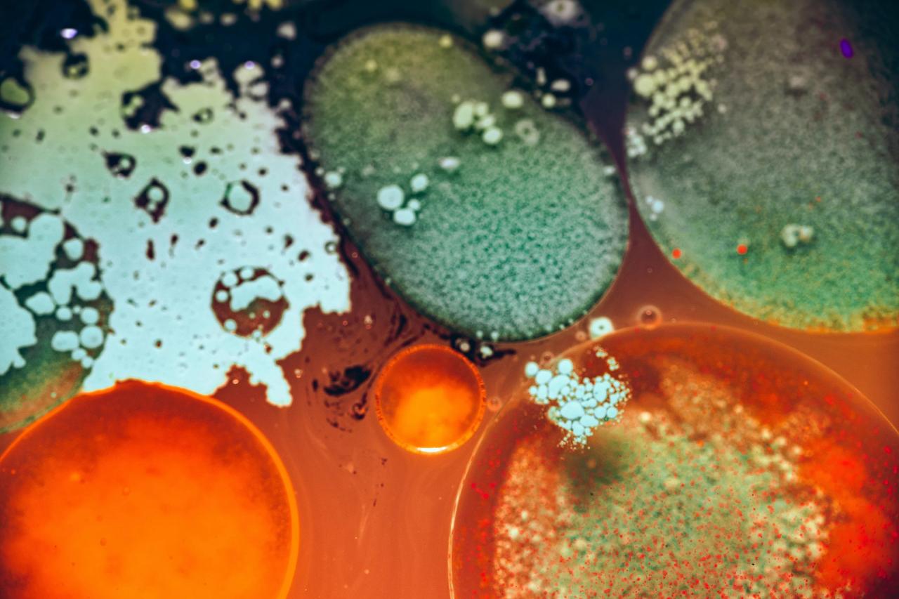 How Embracing Germs Can Encourage Good Health - U of G News Germ the hijinx tape