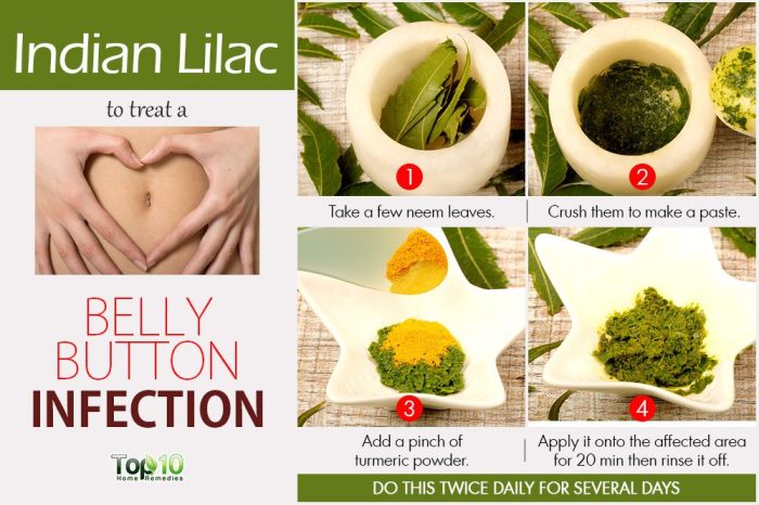 Treat an Infection in Your Belly Button