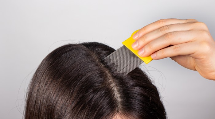 How to Treat an Itchy Scalp - HealthKart Make Your Scalp Stop Itching